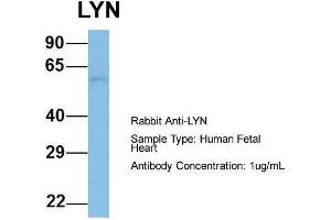 Host: Rabbit  Target Name: LYN  Sample Tissue: Human Fetal Heart  Antibody Dilution: 1. (LYN Antikörper  (N-Term))