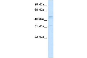 Western Blot showing TCFAP2C antibody used at a concentration of 1-2 ug/ml to detect its target protein. (TFAP2C Antikörper  (N-Term))