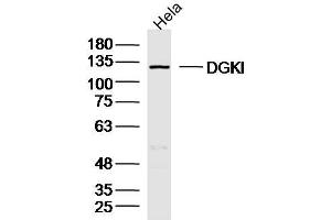 Hela lysates probed with DGKI Polyclonal Antibody, Unconjugated  at 1:300 dilution and 4˚C overnight incubation. (DGKI Antikörper  (AA 101-200))