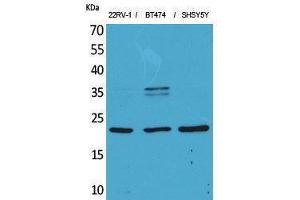 Western Blotting (WB) image for anti-Fibroblast Growth Factor 12 (FGF12) (Internal Region) antibody (ABIN3187704)