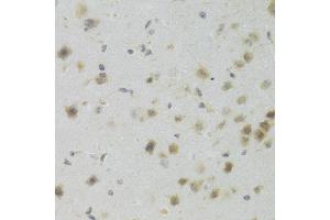 Immunohistochemistry of paraffin-embedded mouse brain using PAWR Antibody (ABIN5971565) at dilution of 1/100 (40x lens). (PAWR Antikörper)