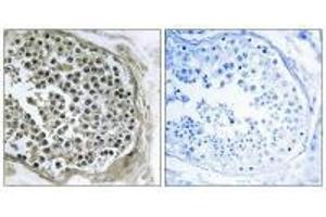 Immunohistochemistry analysis of paraffin-embedded human tesophagusis tissue using GIDRP88 antibody. (GIDRP88 Antikörper)
