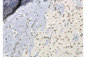 ABIN6261763 and ABIN6266541 at 1/100 staining Mouse brain tissue by IHC-P. (FLI1 Antikörper  (Internal Region))