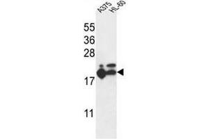 RPL17 Antibody (C-term) western blot analysis in A375,HL-60 cell line lysates (35µg/lane). (RPL17 Antikörper  (C-Term))