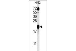 Western blot analysis of GAGE7 Antibody (C-term) (ABIN653712 and ABIN2843026) in K562 cell line lysates (35 μg/lane). (G Antigen 7 Antikörper  (C-Term))