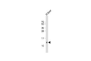 Anti-HP Antibody (Center) at 1:500 dilution + human liver lysate Lysates/proteins at 20 μg per lane. (Hepcidin Antikörper  (AA 17-46))
