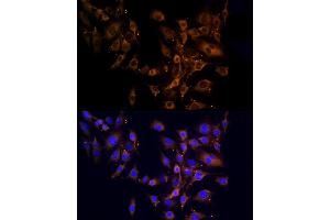 Immunofluorescence analysis of C6 cells using RPL10A Rabbit pAb (ABIN6129099, ABIN6147103, ABIN6147104 and ABIN6221624) at dilution of 1:100 (40x lens). (RPL10A Antikörper  (AA 1-110))