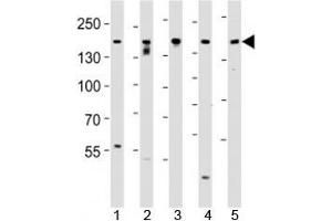 Western blot analysis of lysate from SH-SY5Y, MCF-7, PC3, LNCaP, HeLa, cell line (left to right) using Tuberin antibody at 1:1000 for each lane. (Tuberin Antikörper  (AA 1776-1805))