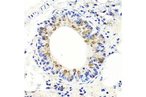 Immunohistochemistry of paraffin-embedded mouse lung using ENDOG antibody. (Endonuclease G Antikörper)