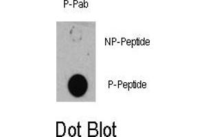 Image no. 1 for anti-Tuberous Sclerosis 1 (TSC1) (pSer505) antibody (ABIN358402) (TSC1 Antikörper  (pSer505))