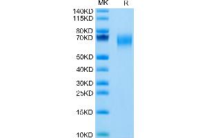 SDS-PAGE (SDS) image for Interleukin 1 Receptor-Like 2 (IL1RL2) (AA 20-335) protein (His tag) (ABIN7274877)