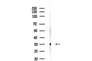 anti-Transcription Factor 21 (TCF21) (Internal Region) antibody