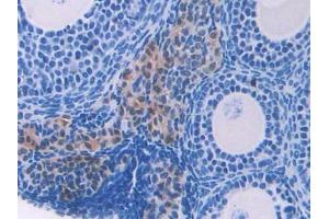 Immunohistochemistry (IHC) image for anti-Fatty Acid Binding Protein 3, Muscle and Heart (FABP3) (AA 1-133) antibody (ABIN1858781)