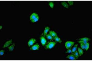Immunofluorescence (IF) image for anti-Phosphoglucomutase 1 (PGM1) (AA 1-562) antibody (ABIN7163274)