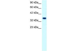 WB Suggested Anti-FOXF1 Antibody Titration:  2. (FOXF1 Antikörper  (C-Term))