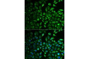 Immunofluorescence analysis of A549 cell using IMPA1 antibody. (IMPA1 Antikörper)