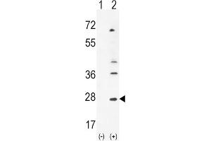 Western Blotting (WB) image for anti-Leukemia Inhibitory Factor (LIF) antibody (ABIN3002910) (LIF Antikörper)