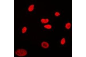 Immunofluorescent analysis of CABLES2 staining in Hela cells.