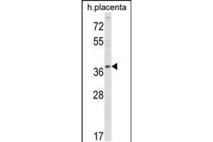 Western blot analysis in human placenta tissue lysates (35ug/lane). (UBE2Q2 Antikörper  (AA 168-196))