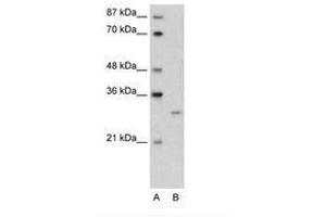 Image no. 1 for anti-Cellular Repressor of E1A-Stimulated Genes 1 (CREG1) (N-Term) antibody (ABIN6736607) (CREG1 Antikörper  (N-Term))