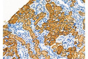 ABIN6257932 and ABIN6275132 at 1/100 staining Rat kidney tissue by IHC-P.