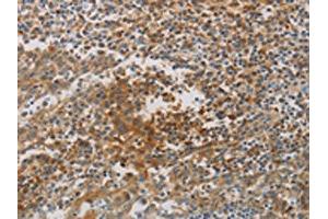 The image on the left is immunohistochemistry of paraffin-embedded Human tonsil tissue using ABIN7190267(CKMT1A/CKMT1B Antibody) at dilution 1/80, on the right is treated with synthetic peptide. (CKMT1A Antikörper)