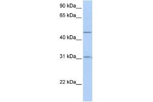 WB Suggested Anti-SLC39A11 Antibody Titration:  0. (SLC39A11 Antikörper  (Middle Region))