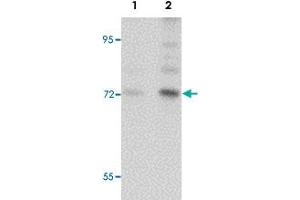 Western blot analysis of BALB/3T3 cells with ARHGAP18 polyclonal antibody  at (Lane 1) 1 and (Lane 2) 2 ug/mL dilution. (ARHGAP18 Antikörper  (C-Term))
