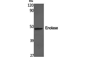 Western Blotting (WB) image for anti-Enolase 2 (Gamma, Neuronal) (ENO2) antibody (ABIN5960961) (ENO2/NSE Antikörper)