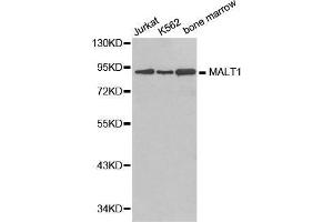 Western blot analysis of extracts of various cell lines, using MALT1 antibody. (MALT1 Antikörper  (AA 125-450))