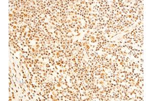ABIN6267237 at 1/100 staining human appendiceal tissue sections by IHC-P. (FOXO3 Antikörper  (pSer253))