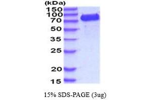 SDS-PAGE (SDS) image for Vascular Cell Adhesion Molecule 1 (VCAM1) (AA 25-698) protein (His tag) (ABIN5854444)