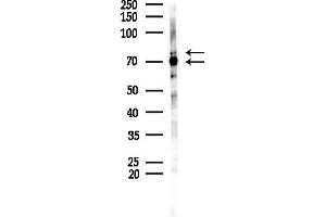 anti-Ku70/80 antibody