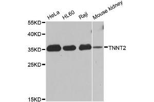 Western blot analysis of extracts of various cell lines, using TNNT2 antibody (ABIN5970474) at 1/1000 dilution. (Cardiac Troponin T2 Antikörper)