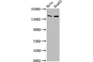 Western Blot Positive WB detected in: Hela whole cell lysate, HepG2 whole cell lysate All lanes: SULF1 antibody at 4 μg/mL Secondary Goat polyclonal to rabbit IgG at 1/50000 dilution Predicted band size: 102 kDa Observed band size: 150 kDa (SULF1 Antikörper  (AA 105-372))