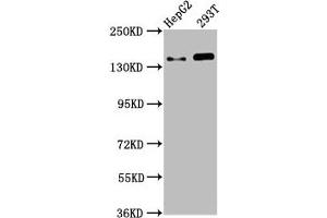 Western Blot Positive WB detected in: HepG2 whole cell lysate, 293T whole cell lysate All lanes: SMC5 antibody at 4.