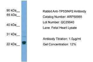 WB Suggested Anti-TP53INP2  Antibody Titration: 0. (TP53INP2 Antikörper  (C-Term))