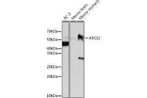 Western blot analysis of extracts of various cell lines, using  antibody (ABIN7265788) at 1:1000 dilution. (ATG12 Antikörper)