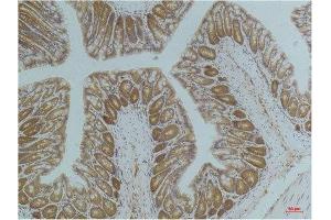 Immunohistochemistry (IHC) analysis of paraffin-embedded Mouse ColonTissue using AMPK a1 Mouse Monoclonal Antibody diluted at 1:200. (PRKAA1 Antikörper)