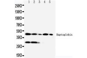 Anti-Haptoglobin antibody, Western blotting Lane 1:RAJI Cell Lysate Lane 2:HL-60 Cell Lysate Lane 3:HUT102 Cell Lysate Lane 4:JURKAT Cell Lysate Lane 5:CEM Cell Lysate (Haptoglobin Antikörper  (Middle Region))