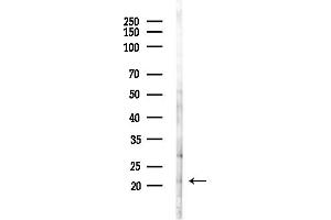 anti-Activating Transcription Factor 3 (ATF3) (C-Term) antibody