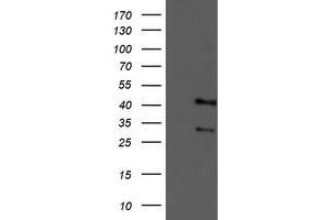 Western Blotting (WB) image for anti-Tropomodulin 1 (TMOD1) antibody (ABIN1501528)