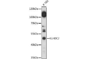Western blot analysis of extracts of K-562 cells, using KLHDC2 antibody (ABIN7268073) at 1:1000 dilution. (KLHDC2 Antikörper  (AA 1-240))
