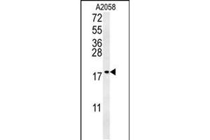 Western blot analysis in A2058 cell line lysates (35ug/lane). (GM2A Antikörper  (N-Term))