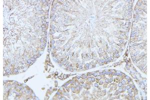 ABIN6279778 at 1/100 staining Mouse testis tissue by IHC-P. (RND2 Antikörper  (Internal Region))
