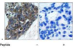 Image no. 1 for anti-Mitogen-Activated Protein Kinase Kinase Kinase 5 (MAP3K5) (Ser966) antibody (ABIN197326) (ASK1 Antikörper  (Ser966))