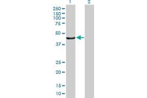 Western Blot analysis of PTPN2 expression in transfected 293T cell line by PTPN2 MaxPab polyclonal antibody. (PTPN2 Antikörper  (AA 1-387))