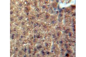 Used in DAB staining on fromalin fixed paraffin-embedded Liver tissue (CCL3L1 Antikörper  (AA 1-93))