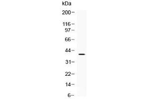 Western blot testing of mouse brain lysate with MC2R antibody at 0.