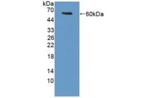 Detection of Recombinant TGM1, Mouse using Polyclonal Antibody to Transglutaminase 1 (TGM1) (TGM1 Antikörper  (AA 337-607))